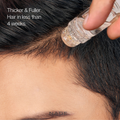Cellular Hairline Renewal System + DHT Blocking Peptide Serum - 2 Month Supply - 1 Free Month Included.