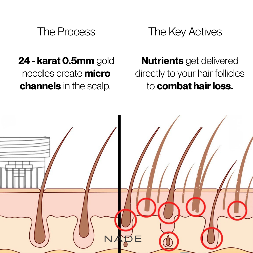 Cellular Hairline Renewal System + DHT Blocking Peptide Serum - 2 Month Supply - 1 Free Month Included.