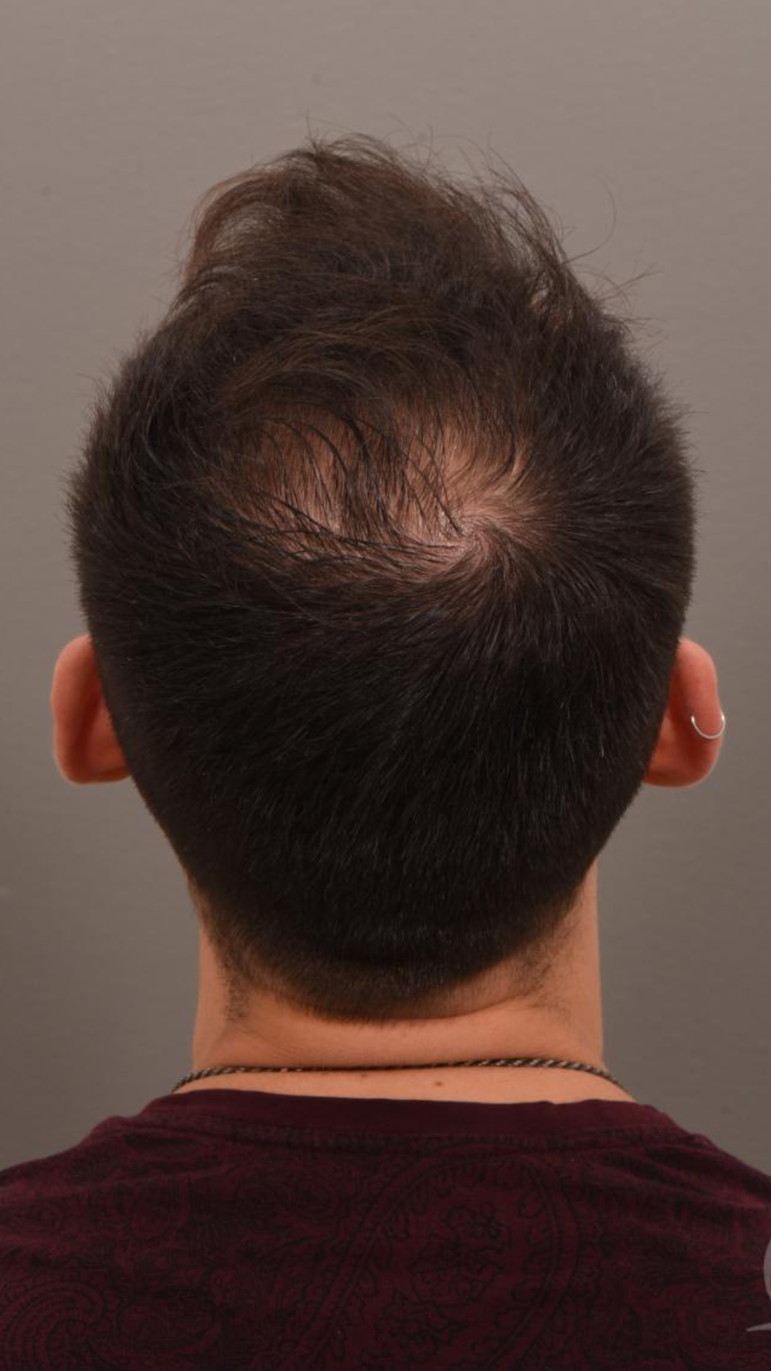 Before transformation 1