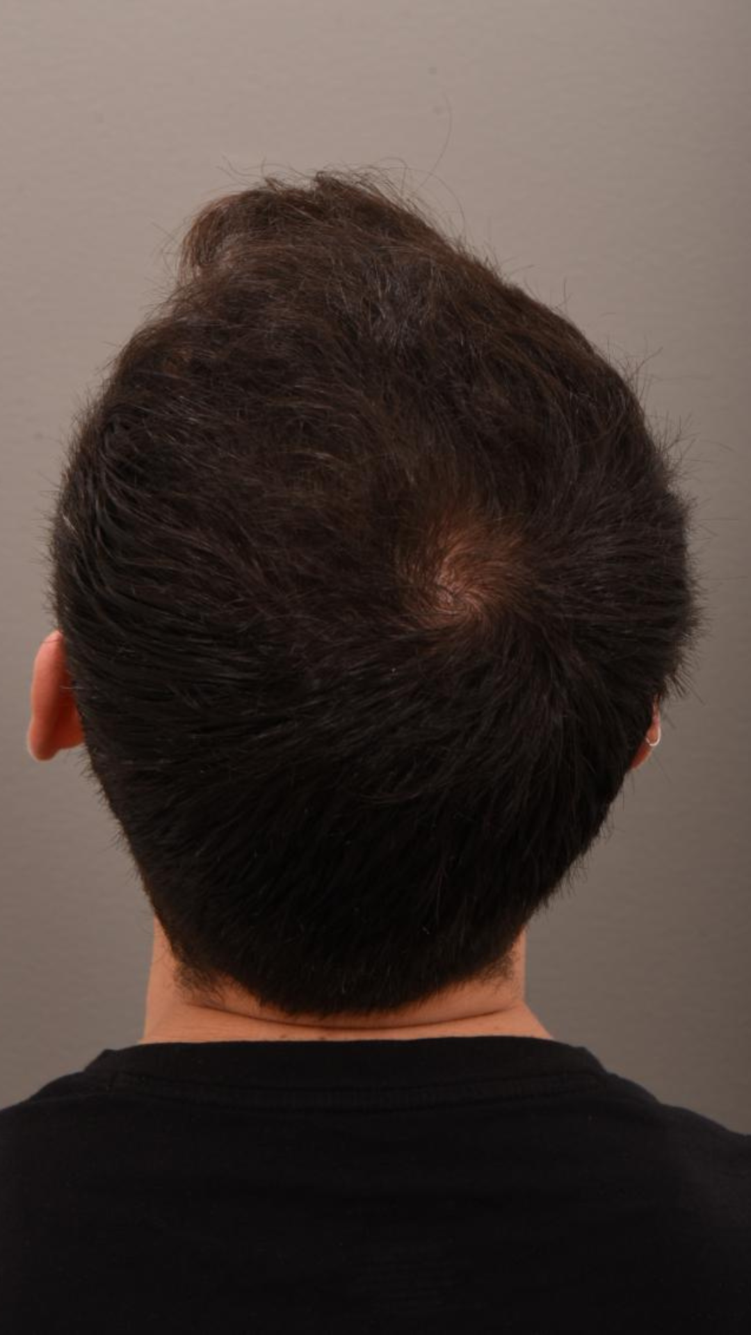 After transformation 1