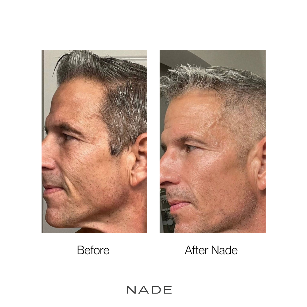 NADE Micro Infusion System + NAD+ & Copper Peptide Serum