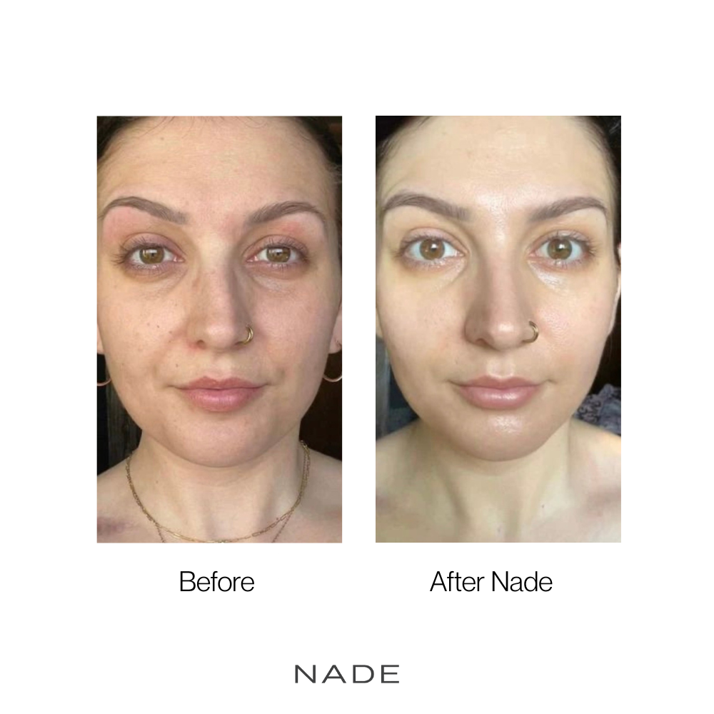 NADE Micro Infusion System + NAD+ & Copper Peptide Serum
